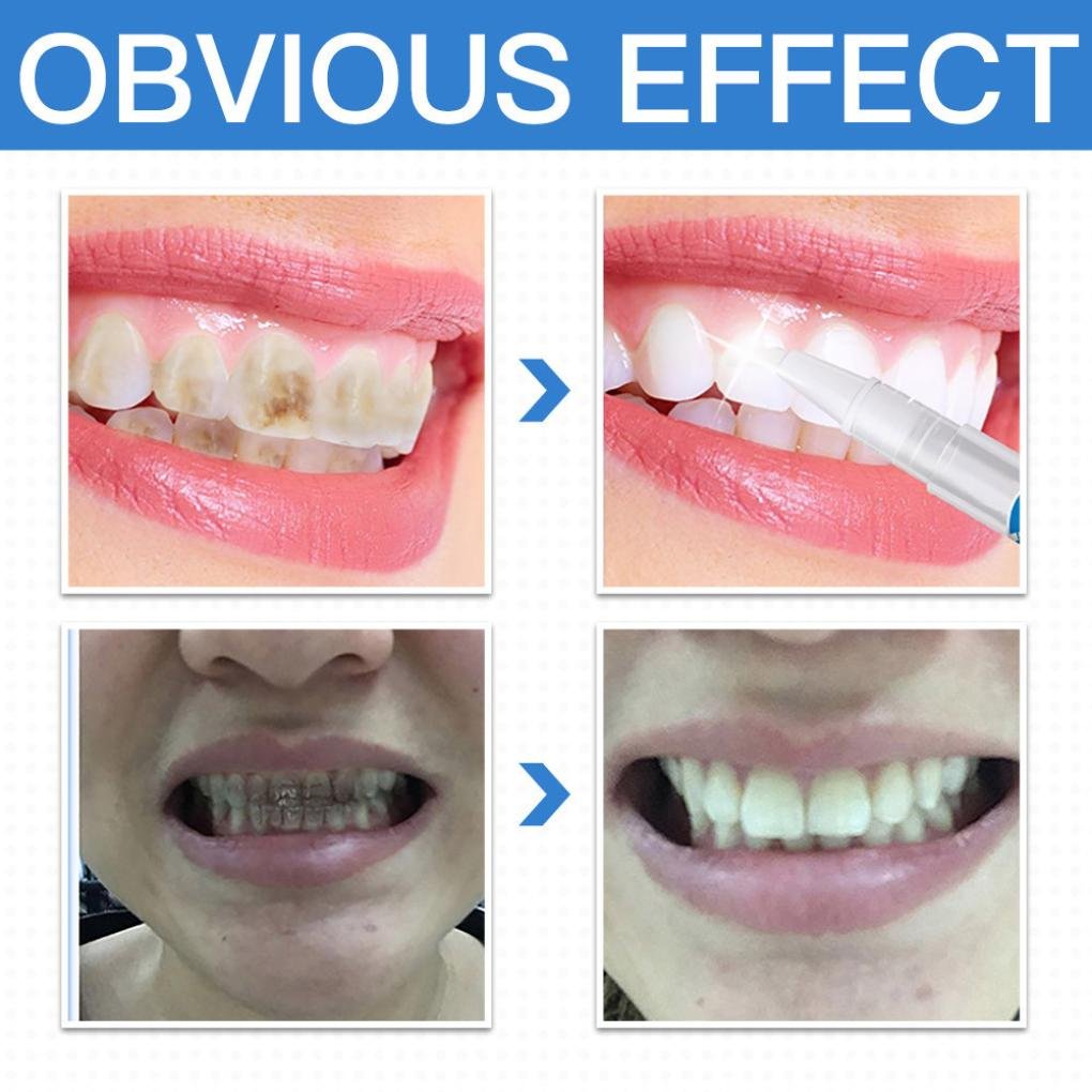 LAPIZ BLANQUEADOR DENTAL